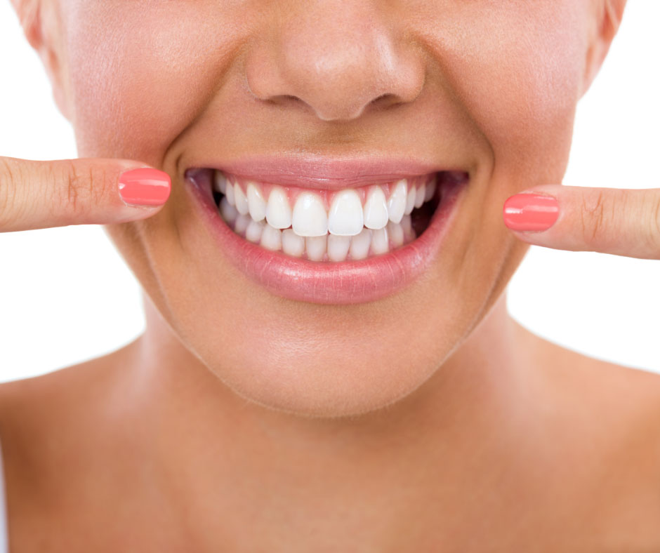 Bagaimana Cara Pakai Teeth Whitening Yang Benar? - Transform Your ...