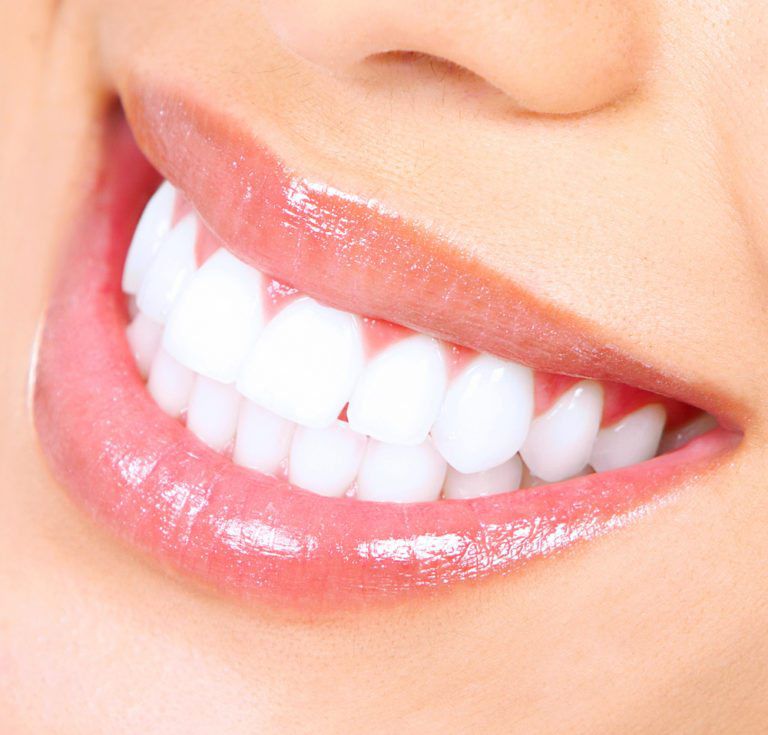 cara pakai teeth whitening